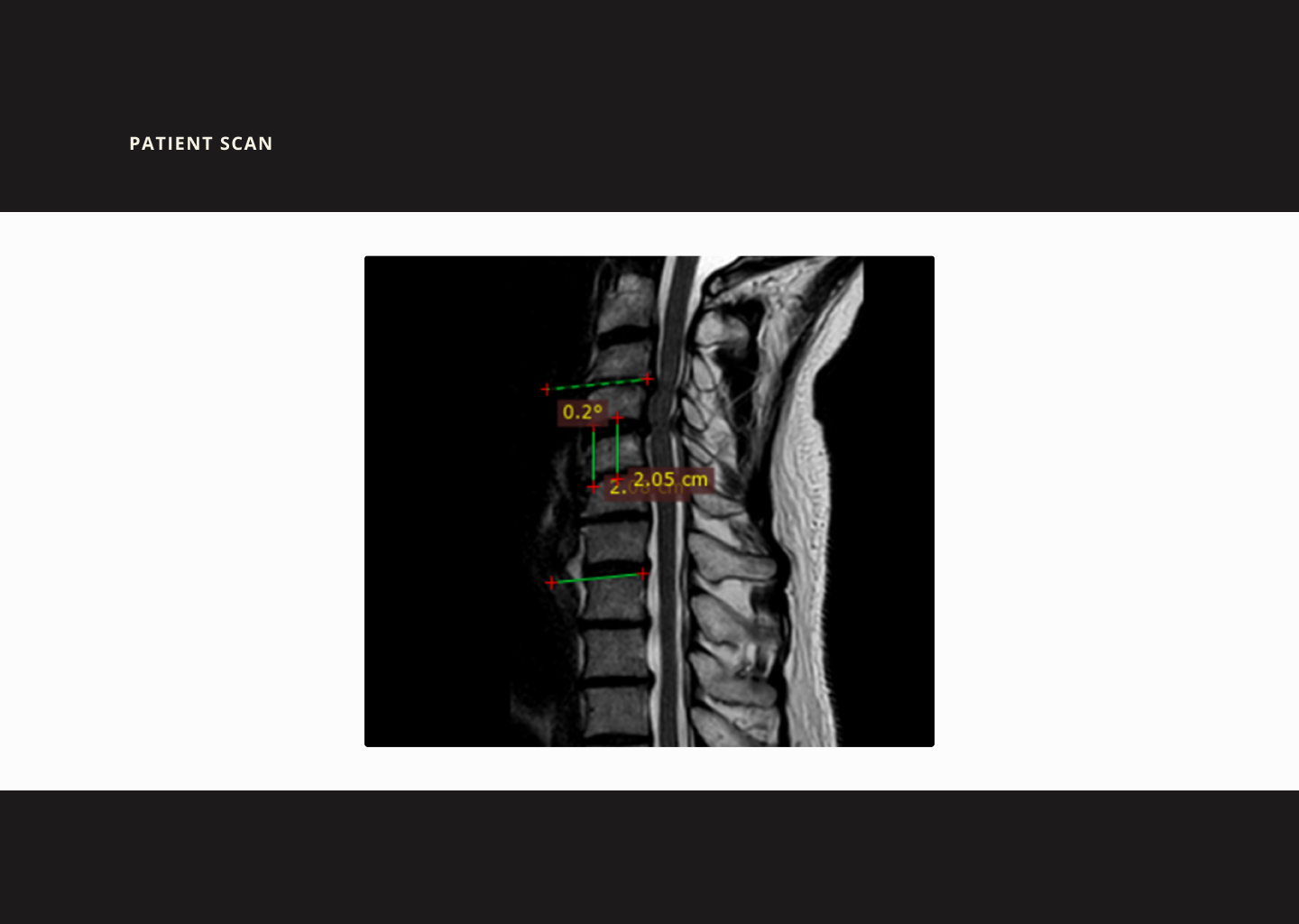 Slide 11 - Patient Scan