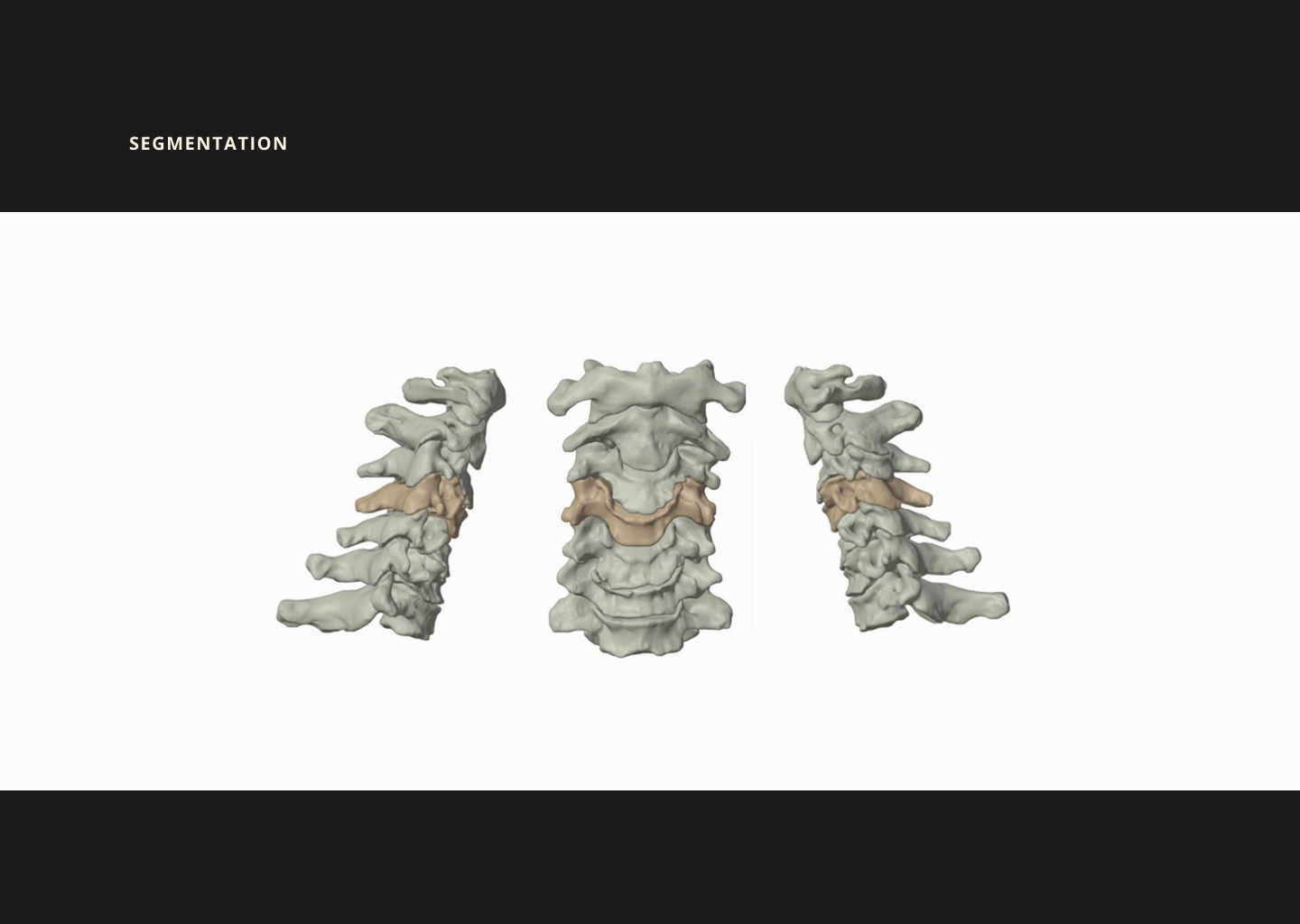 Slide 12 - Segmentation