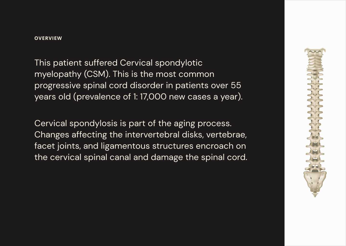 Slide 4 - Overview