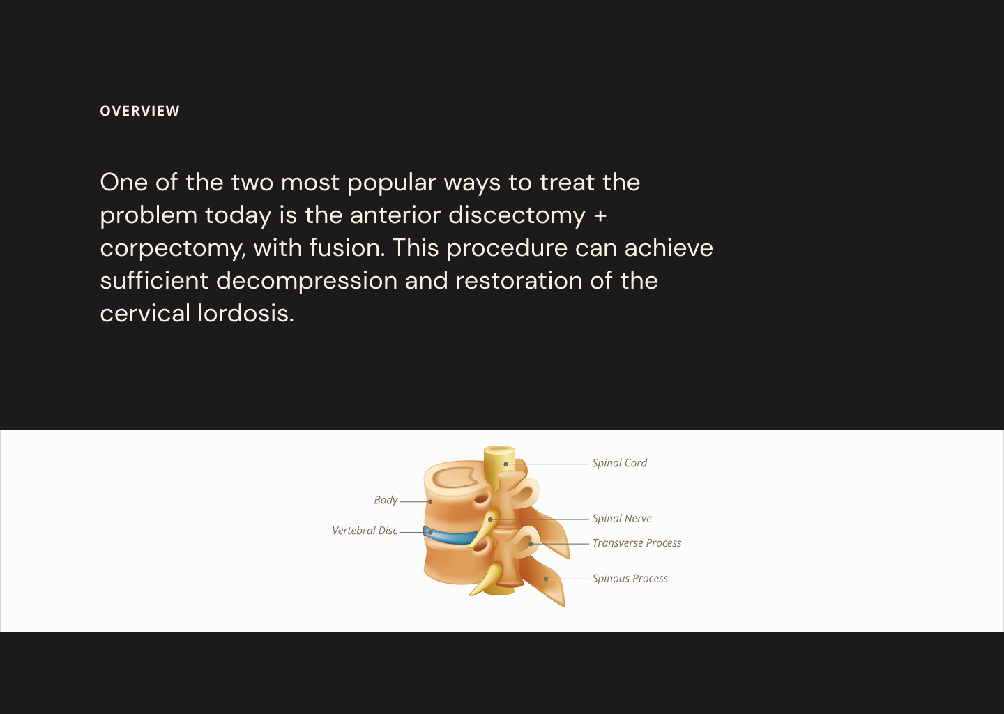 Slide 5 - Overview